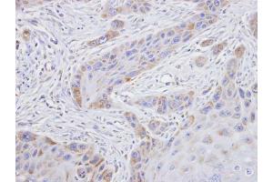 IHC-P Image Immunohistochemical analysis of paraffin-embedded SCC15 xenograft, using TROVE2, antibody at 1:100 dilution.