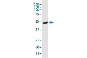 UGCG monoclonal antibody (M03), clone 1E5. (UGCG antibody  (AA 33-131))