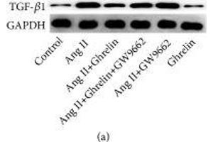 Ghrelin attenuated TGF-β1 and TGF-β1 signaling in Ang II-stimulated cardiac fibroblasts. (GAPDH antibody  (AA 1-335))