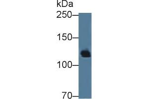 Detection of AMPH in Mouse Cerebrum lysate using Polyclonal Antibody to Amphiphysin (AMPH) (Amphiphysin antibody  (AA 24-240))