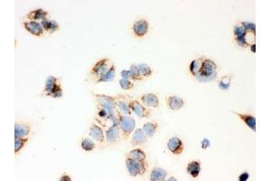 Immunohistochemistry (IHC) image for anti-Hydroxysteroid (17-Beta) Dehydrogenase 10 (HSD17B10) (AA 48-261) antibody (ABIN3031271)