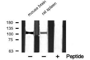 Western blot analysis of extracts of various smaple,using PMYPT1 (Phospho-Thr853) Antibody. (PPP1R12A antibody  (pThr853))