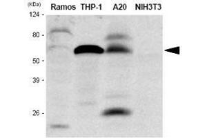 The extracts of Ramos, THP-1, A20 and NIH3T3 were resolved by SDS-PAGE, transferred to PVDF membrane and probed with anti-human IRF-5 antibody (1:1,000). (IRF5 antibody  (AA 176-240))