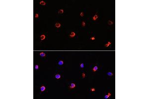 Immunofluorescence analysis of Y79 cells using  antibody (ABIN6129964, ABIN6136691, ABIN6136693 and ABIN6222112) at dilution of 1:100. (AIPL1 antibody  (AA 1-384))