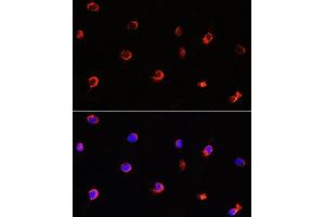 Immunofluorescence analysis of Y79 cells using  antibody (ABIN6129964, ABIN6136691, ABIN6136693 and ABIN6222112) at dilution of 1:100. (AIPL1 antibody  (AA 1-384))