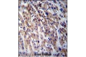 CPN1 Antibody (Center) (ABIN656809 and ABIN2846023) immunohistochemistry analysis in formalin fixed and paraffin embedded human liver tissue followed by peroxidase conjugation of the secondary antibody and DAB staining. (CPN1 antibody  (AA 210-240))