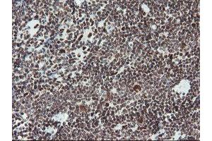 Image no. 8 for anti-TP53RK Binding Protein (TPRKB) antibody (ABIN1501484)