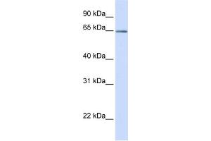 WB Suggested Anti-OPTN Antibody Titration:  0. (OPTN antibody  (C-Term))