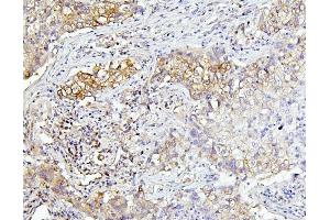 IHC analysis of EIF4A using anti-EIF4A antibody (ABIN7601309). (EIF4A1 antibody  (AA 32-406))