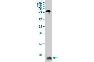 ATOX1 monoclonal antibody (M08), clone 4D6. (ATOX1 antibody  (AA 1-68))