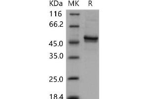 Western Blotting (WB) image for Casein Kinase 1, gamma 2 (CSNK1G2) (Active) protein (His tag) (ABIN7317052) (Casein Kinase 1 gamma 2 Protein (His tag))