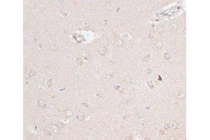 Immunohistochemistry of paraffin-embedded Rat brain using ABCF2 Polyclonal Antibody at dilution of 1:100 (40x lens).