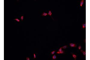ABIN6278174 staining HepG2? (FOXA1 antibody  (C-Term))