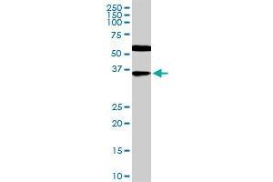 CDX4 monoclonal antibody (M12), clone 1E9. (CDX4 antibody  (AA 202-284))