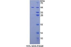 Image no. 1 for Thyroid Stimulating Hormone, beta (TSHB) (AA 20-138) protein (His tag,GST tag) (ABIN4989772) (TSHB Protein (AA 20-138) (His tag,GST tag))