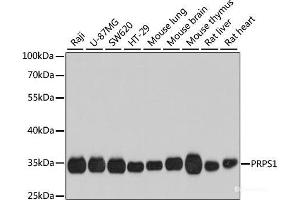 Western blot analysis of extracts of various cell lines using PRPS1 Polyclonal Antibody at dilution of 1:1000. (PRPS1 antibody)