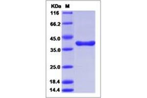 SDS-PAGE (Guinea Pig anti-Rabbit IgG (Heavy & Light Chain) Antibody (FITC) - Preadsorbed)