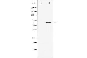 Western blot analysis of Elk1 expression in heatshock treated HeLa whole cell lysates,The lane on the left is treated with the antigen-specific peptide. (ELK1 antibody  (C-Term))