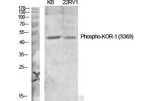 Western Blot (WB) analysis of specific cells using Phospho-KOR-1 (S369) Polyclonal Antibody. (OPRK1 antibody  (pSer369))