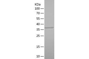 Western Blotting (WB) image for serine Peptidase Inhibitor, Kunitz Type 1 (SPINT1) (AA 130-249) protein (His-IF2DI Tag) (ABIN7282578) (SPINT1 Protein (AA 130-249) (His-IF2DI Tag))
