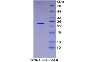 SDS-PAGE analysis of Mouse DVL1 Protein.