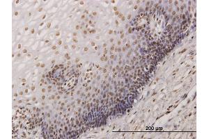 Immunoperoxidase of monoclonal antibody to KHSRP on formalin-fixed paraffin-embedded human esophagus. (KHSRP antibody  (AA 151-239))