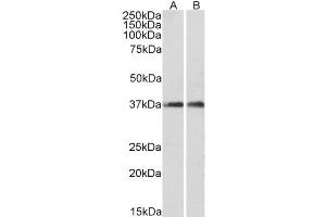 Western Blot (0. (ARPC1A antibody  (C-Term))