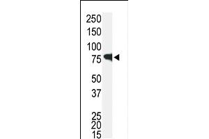 Western blot analysis of anti-IRAK1 Pab (ABIN392233 and ABIN2841927) in Jurkat cell lysate. (IRAK1 antibody  (C-Term))