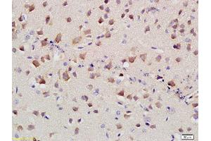 Formalin-fixed and paraffin embedded mouse brain labeled with Anti-SLC4A4 Polyclonal Antibody, Unconjugated at 1:400 followed by conjugation to the secondary antibody and DAB staining (kNBC (AA 1-100) antibody)