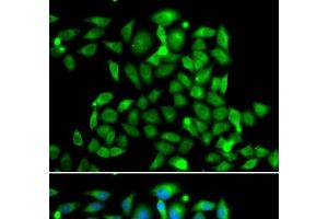 Immunofluorescence analysis of A549 cells using CLASP1 Polyclonal Antibody