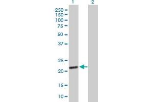 Western Blot analysis of EXOSC1 expression in transfected 293T cell line by EXOSC1 MaxPab polyclonal antibody. (EXOSC1 antibody  (AA 1-195))
