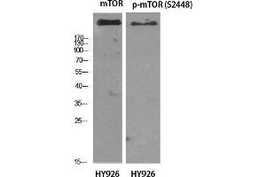 Western Blot (WB) analysis of specific cells using mTOR Polyclonal Antibody. (MTOR antibody  (Ser396))