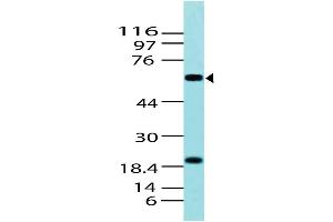 Image no. 1 for anti-T-Complex 1 (TCP1) (AA 1-202) antibody (ABIN5027416) (TCP1 alpha/CCTA antibody  (AA 1-202))