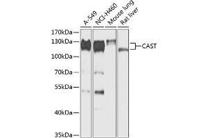 Western blot analysis of extracts of various cell lines, using CAST antibody (ABIN6133634, ABIN6137983, ABIN6137985 and ABIN6217769) at 1:1000 dilution. (Calpastatin antibody  (AA 550-650))