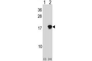 Western blot analysis of SUMO4 antibody and 293 cell lysate either nontransfected (Lane 1) or transiently transfected (2) with the SUMO4 gene. (SUMO4 antibody)