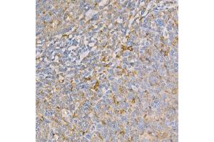 Immunohistochemistry of paraffin-embedded human tonsil using GSDMD (Full Length+N terminal) Rabbit pAb  at dilution of 1:100 (40x lens). (GSDMD antibody)