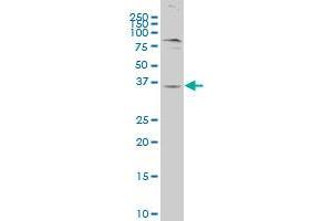 GPR62 polyclonal antibody (A01), Lot # 050926JC01. (GPR62 antibody  (AA 314-368))