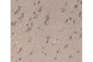 Used in DAB staining on fromalin fixed paraffin- embedded brain tissue (Complexin 1 antibody  (AA 1-134))