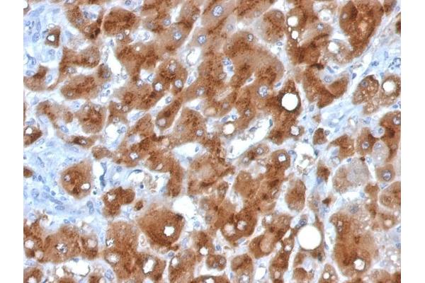 SAA antibody