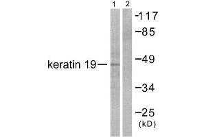 Western Blotting (WB) image for anti-Keratin 19 (KRT19) (Internal Region) antibody (ABIN1848635) (Cytokeratin 19 antibody  (Internal Region))