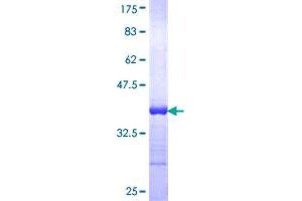 CKMT1B Protein (AA 327-417) (GST tag)