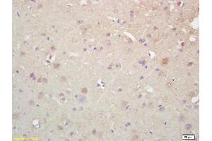 Formalin-fixed and paraffin embedded rat brain labeled with Rabbit Anti KIF5A/NKHC1 Polyclonal Antibody, Unconjugated (ABIN1387674) at 1:200 followed by conjugation to the secondary antibody and DAB staining