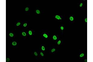 Immunofluorescence staining of Hela cells (treated with 30mM sodium butyrate for 4h) with ABIN7139195 at 1:2. (HIST1H2AG antibody  (acLys74))