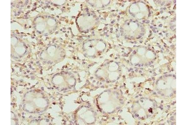 DENND5A antibody  (AA 1-300)