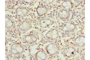 Immunohistochemistry of paraffin-embedded human colon tissue using ABIN7149683 at dilution of 1:100