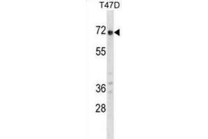 Western Blotting (WB) image for anti-Glypican 2 (GPC2) antibody (ABIN2998770)
