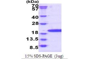 SDS-PAGE (SDS) image for Processing of Precursor 7, Ribonuclease P/MRP Subunit (POP7) (AA 1-140) protein (His tag) (ABIN6387456) (POP7 Protein (AA 1-140) (His tag))