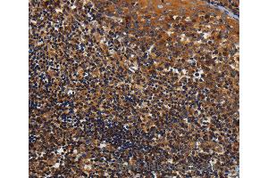 Immunohistochemistry of Human tonsil using KCNK17 Polyclonal Antibody at dilution of 1:60 (KCNK17 antibody)