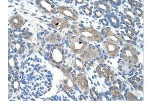 Image no. 1 for anti-Radical S-Adenosyl Methionine Domain Containing 2 (RSAD2) (C-Term) antibody (ABIN203447) (RSAD2 antibody  (C-Term))