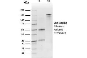 SDS-PAGE Analysis Purified CD19 Monospecific Mouse Monoclonal Antibody (CD19/3116). (CD19 antibody  (AA 96-281))
